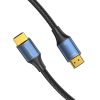 HDMI 2.1 Cable Vention ALGLH , 2m, 8K 60Hz/ 4K 120Hz (Blue)