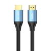 HDMI 2.0 Cable Vention ALHSH, 2m, 4K 60Hz, 30AWG (Blue)