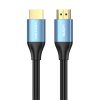 HDMI 2.0 Cable Vention ALHSJ, 5m, 4K 30Hz, 30AWG (Blue)